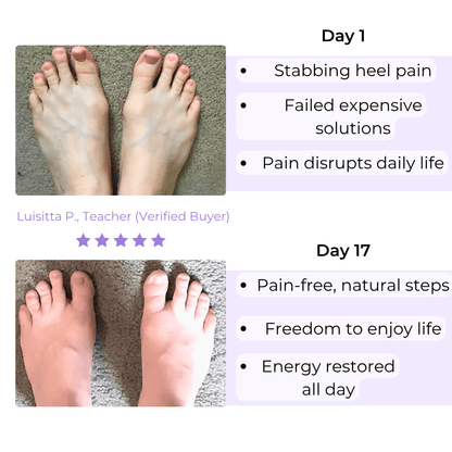 Neurelaxa™ Toe Spacers